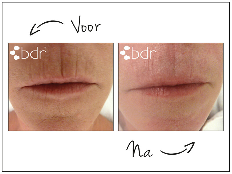 Maak kennis met bdr!