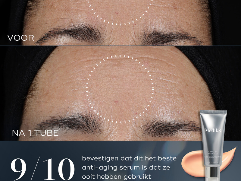 Medik8's Crystal Retinal: goodbye RetinOL, hello RetinAL 