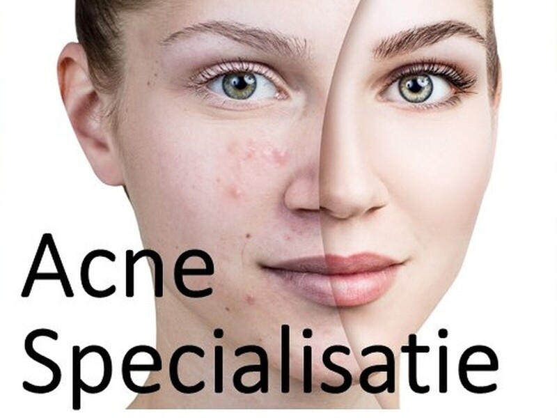 Online training Acne Specialisatie