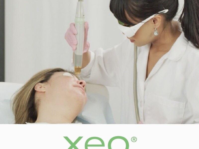 De vier kerntechnologieën van Cutera XEO